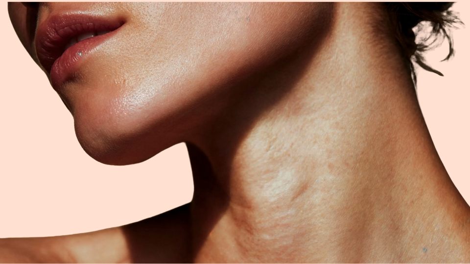 hautqualitaet-nach-polynukleotiden-seesthetics.png Alt-Text: Sichtbar gefestigte Hautstruktur und natürlicher Glow nach einer Kur mit Polynukleotiden bei Seesthetics.